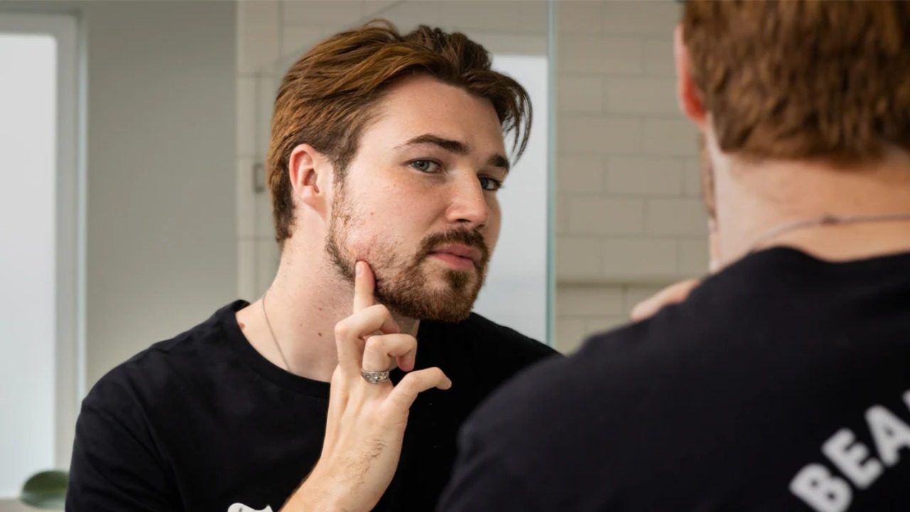 Why Beard Growth Turns Uneven in the First Place